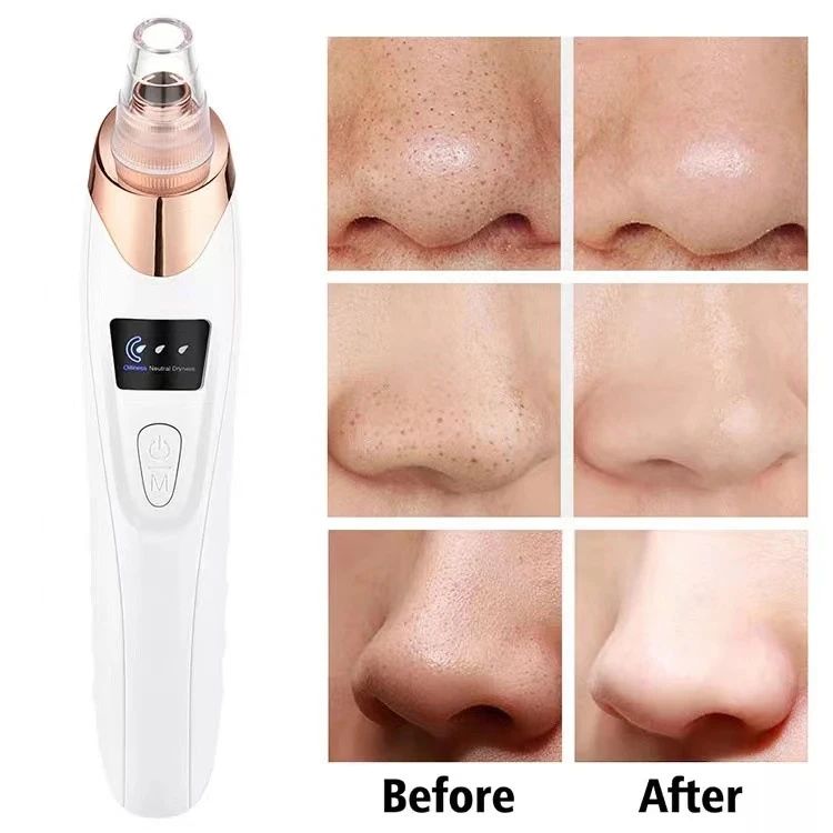 Facial Cleaner Derma Suction Device