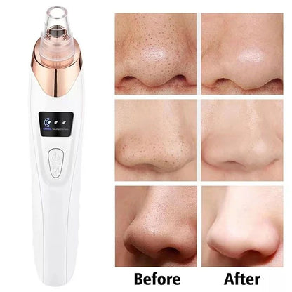 Facial Cleaner Derma Suction Device